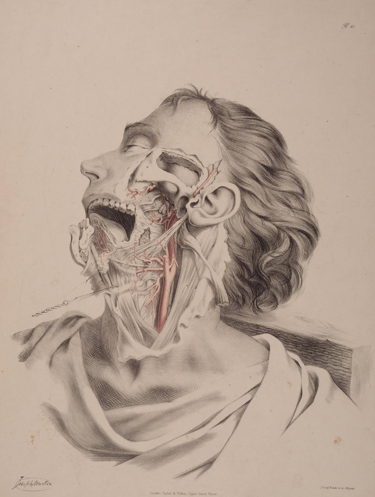 Planche 10 de Quain : tête renversée, bouche ouverte, la dissection du cou montre les artères en rouge